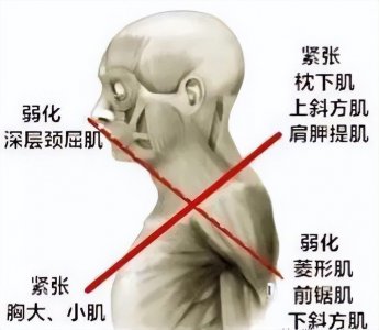 ​颈肩肌肉拉伸解剖图谱！10个拉伸动作，告别肩颈疼痛就靠它！