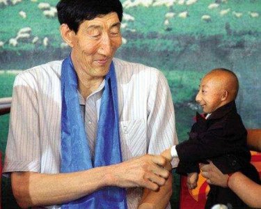 ​最矮袖珍人出生时不足1斤，没一个巴掌大，一天2包烟，21岁病亡！