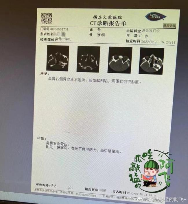 莲花楼代拍被打致鼻骨骨折 涉事人员被警方带走
